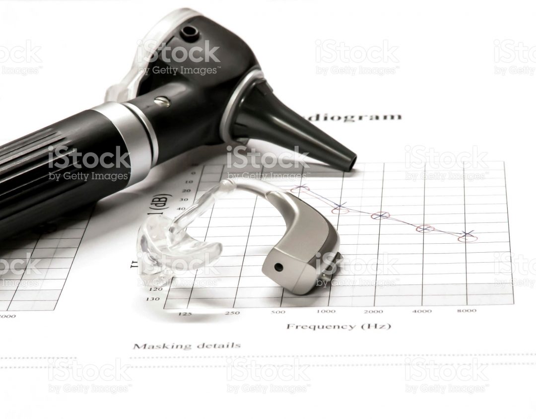 Audio-prosthetic - Precision Hearing Audiology